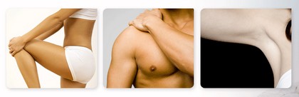 Trval� depilace